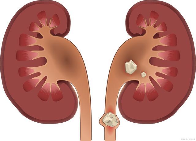 肾脏疾病前沿探索：最新研究成果揭秘